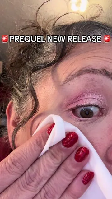 This is just for us rosacea girls! #tiktokshopcreatorpicks #prequel #rosacea 
