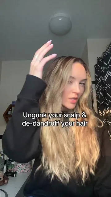 The itchy gunk and flakes aren't cute. #haircare #dandruff #scalphealth #shampoo 