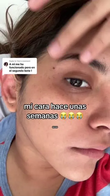 Replying to @Taty con esto te funciona mas rapido!! #amtiedad #glowup #skincare #pielbonita #pielsaludable 