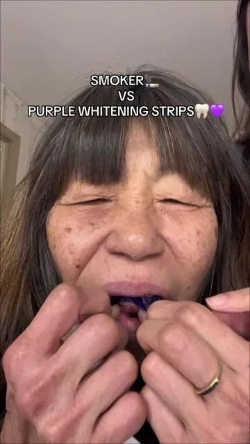 i was shook  #teethwhitening #yellowteeth #glowup 