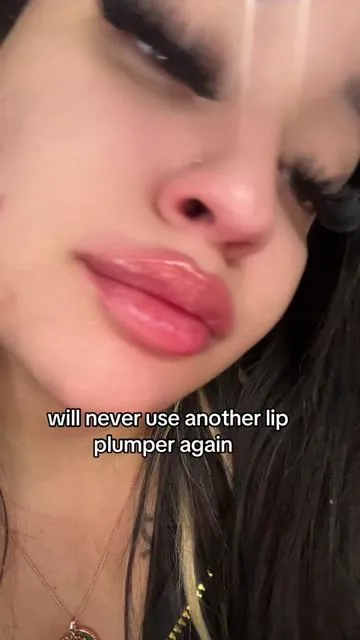 all i ever need forget lip filler  #viral #foryoupage #trend 