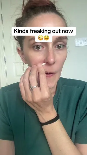 I grasp that the hypochlorous acid mixed with the witch hazel is ultra cleansing and purifying and helps prevent bacteria but like HOW did one 20 minute mask use just undo what I’ve spent a literal decade trying to figure out/fix. Like…I’m mortified. And also so happy.  #hypochlorousacidmask #hypochlorousacid #medicubehypochrousacid #acneproneskin #kbeauty 