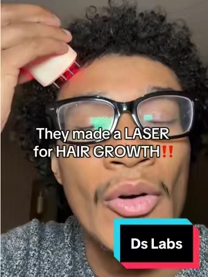 My hairline THAKS this! #hair #hairgrowth #hairloss #hairgrowthtips #hairline