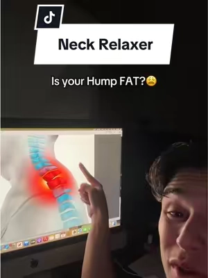 Relieve your neck pain and fix your posture #neckpain #badposture #neckpainrelief #posturecorrection #tiktokmademebuyit 