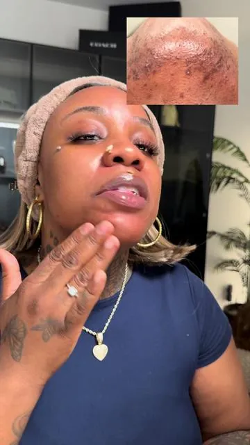 Clear Calm Confident Skin Radiant Skin all in one🤯
