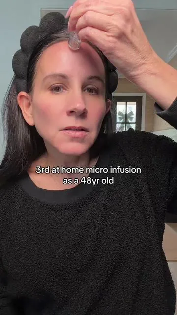 Loving my results from my 3rd micro infusion. #beautyover40 #skincareroutine #skincare #microinfusion #selfcare 