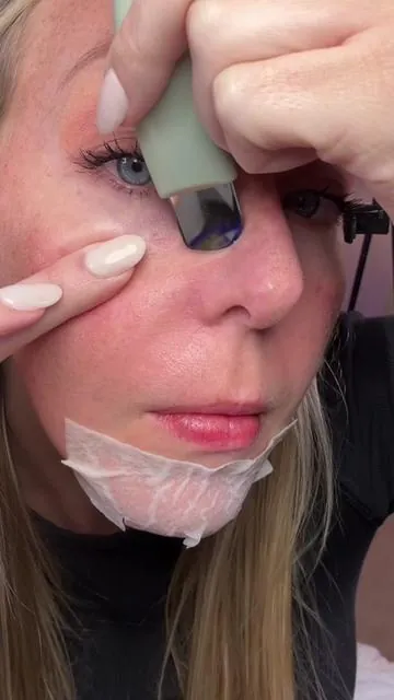 All that even after cleaning my face 🙃 #tiktokshopcreatorpicks #tiktokshopspringglowup #weeklydeals #blackhead #skincare 