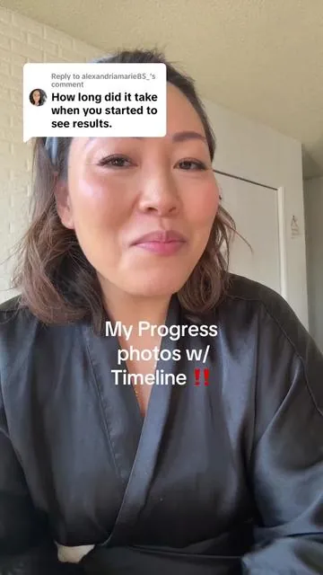 Replying to @alexandriamarie85_ @Expressions_official #cellulite #anticellulitemassage #saggyskin #skintightening #skintighteningtreatment 