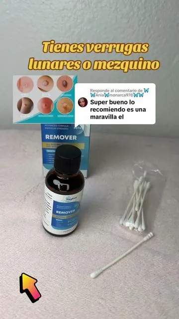 Respuesta a @🦋🦋Ania🦋monarca978🦋🦋 #verrugas #lunares #mesquinos 