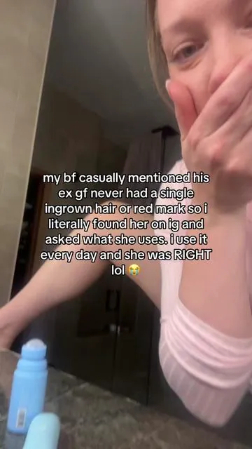 honestly she was 😭  #ingrownhair #shavingbumps #ingrownhairs #bfrelatable #couplegoals      