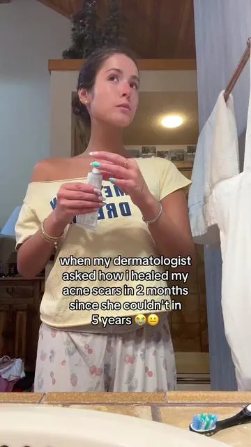 my skin feels so free without them!! #skintok #glowup #skincare 