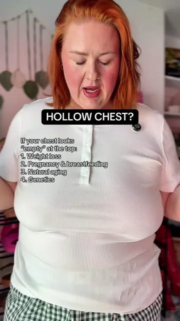 My chest has always been this way.. I truly believe it mainly genetics! When they’re heavy they will droop overtime. But it is possible to wear a jelly bra and be comfortable everyday! I hope you give it a chance. #jellybra #wirelessbra #plussizebra #plussizetryon @Soft Intention US @Soft Intention 