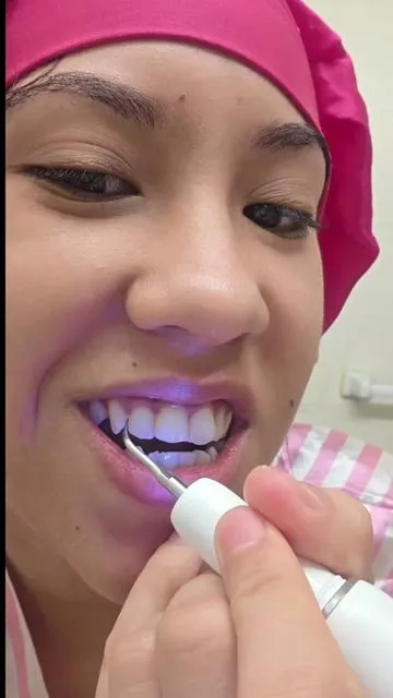 Mantener una buena higiene bucal ahora es mas facil con este limpiador multifuncion que te va a estar realizando una limpieza profunda sin complicaciones 😉 #dientes#boca#higiene@CURVY MOON SHOP 