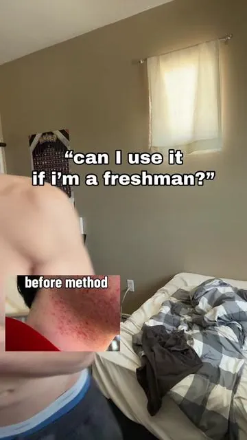 you guys are so lucky. here’s the method i used to ascend @BASED #sponsored #acne #skincare #razorburn #shaving 