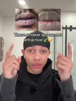 This is the method for dark lips #darklips #drylips #theordinary #lipcare #personalcare 