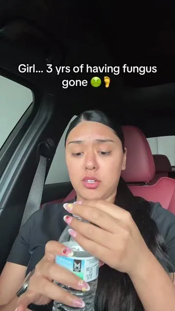 #toenail #fungalinfection #fungi #ladies 