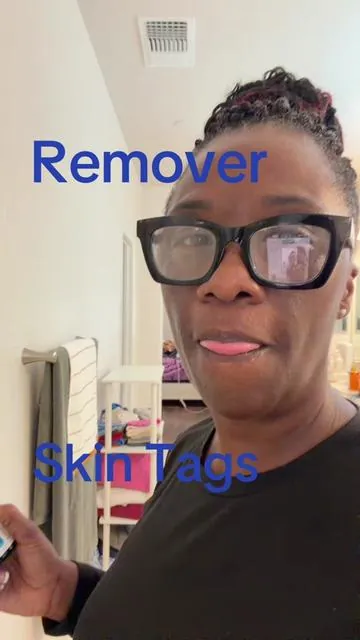 #removerskintags#moles#ragkun