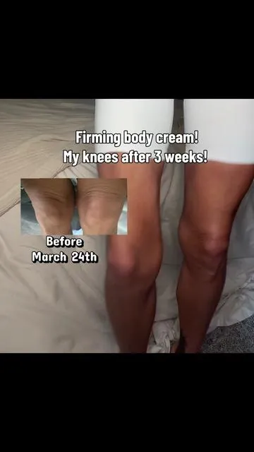 When you see the difference you believe in the product! 3000 peptides to firm the skin! 3 week update!! #saggyskin #knees #firming #asterwood #firmingcream 
