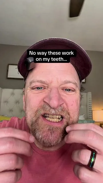 Let’s give these a try to see if they work on my teeth… #whiteningstrips #teethwhiteningstrips #teethwhitening #yellowteeth #oralcare @Hismile US 