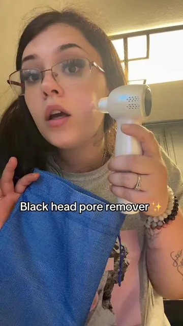Black head pore remover ✨ 