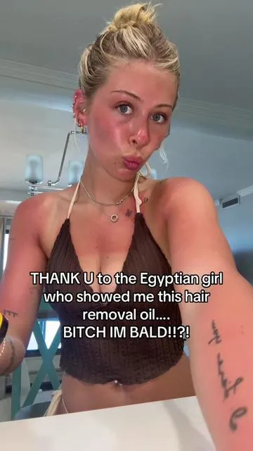 BALD EVERYWHERE 