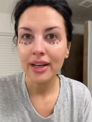 Under eye dream 💜  #darkcircles #darkundereye #matureskincare #kbeauty #drmelaxin @Dr.Melaxin 