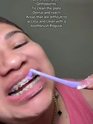 🚨 Si tienes brackets NECESITAS este cepillo 😳🦷 limpia donde otros no llegan y evita infecciones #CepilloOrtodoncia #DientesSanos #AdiosBacterias #CuidadoDental #TikTokShop