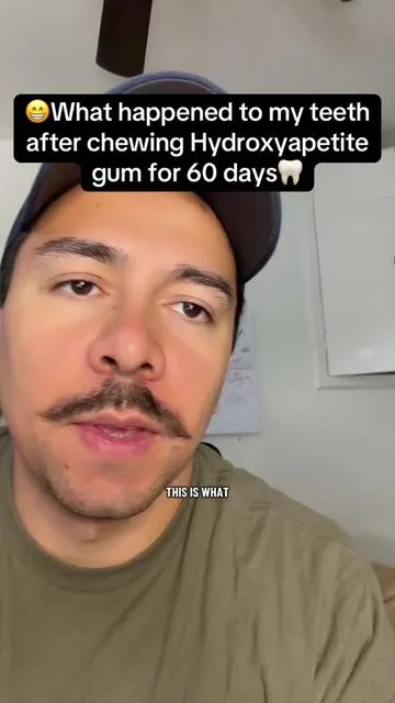 What happened to my teeth after chewing Hydroxyapetite gum for 60 days? #hydroxyapatite #oralcare #dentalcare #teeth #whiteteeth 