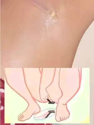 Natural hair reduction 