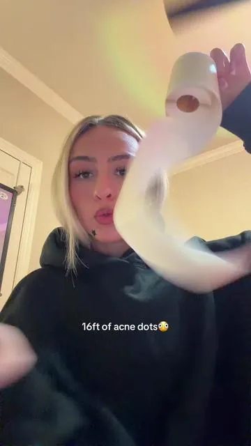 #pimplepatch #acne #tiktokshopfinds 