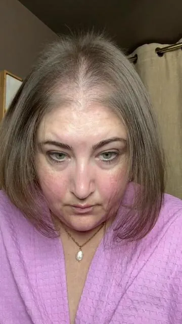 @medicube US Store #hairloss #hairgrowth 