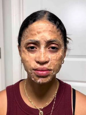 This works so much better than I thought it would. It is the most intense mask but gave me the best results! #skincare #antiaging #snakevenompeptide #summervibes #tiktokshopdealsforyoudays 