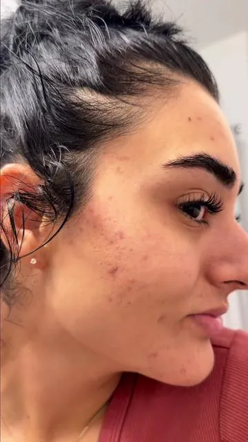 Yo siento que mi piel se ve rositaaaa!🥰 