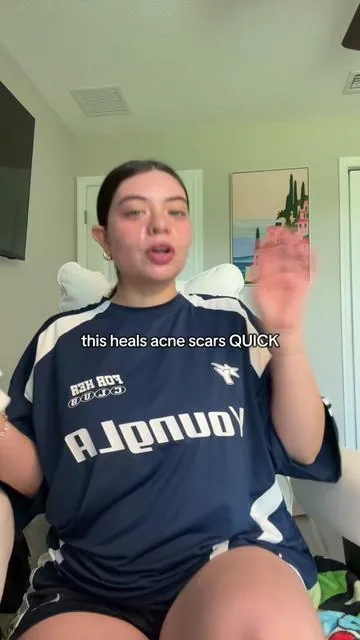 I love dr althea's 345 bundle this stuff CLEARS acne scars it's so fun to see the progress #acnetreatment #acnescars #acneproneskin #acneskincare #acnejourney 