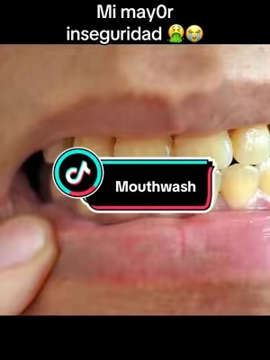To the Dentist that put me on… I OWE YOU!!!! #teethcare 