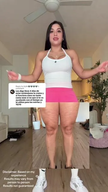 Replying to @Aylin👽👽👽👽  Ahora si Amo mis piernas 😍 Disclaimer: Based on my experience  Results may vary from person to person Results not guaranteed  #cellulite #firminggel #firmskin #smoothskin #stretchmarks @ningdermologieoff 