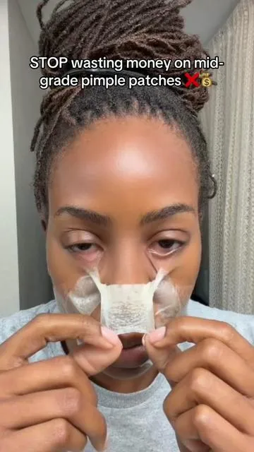 SAVES MONEY AND WORKS BETTER?!Yessirrrr! 😍If you struggle with stubborn breakouts, whiteheads, clogged pores, hormonal acne, or skin picking, these medical-grade hydrocolloid patches might be worth trying. 