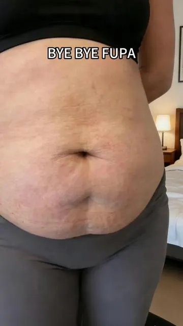 It’s on sale now#belly #fupa #lymphaticdrainage #csectionmom #massagetherapy 