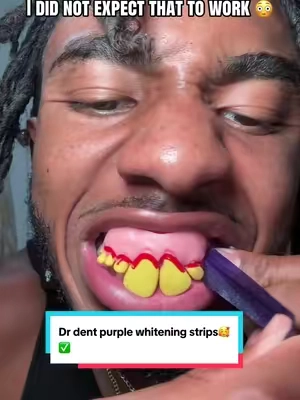 I was not expecting that…#dealsforyoudays #tiktokshopmademebuyit #teethwhiteningstrips #teethwhitening #drdent 