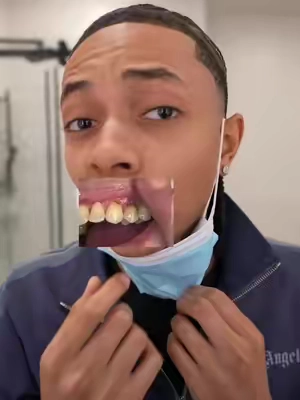 #teethsensitivity #gingivitis #mouthwash #gurunanda #DealsForYouDays 