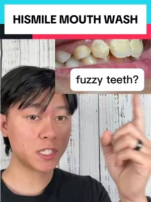this works so good! #teethsensitivity #gingivitis #oralhealth #SummerWins #DealsForYouDays @hismile 