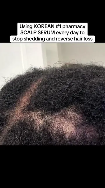 Hair serum  #dealsforyoudays #summerwins ##tiktokshopcreatorpicks  @Dr.Reju-All US 