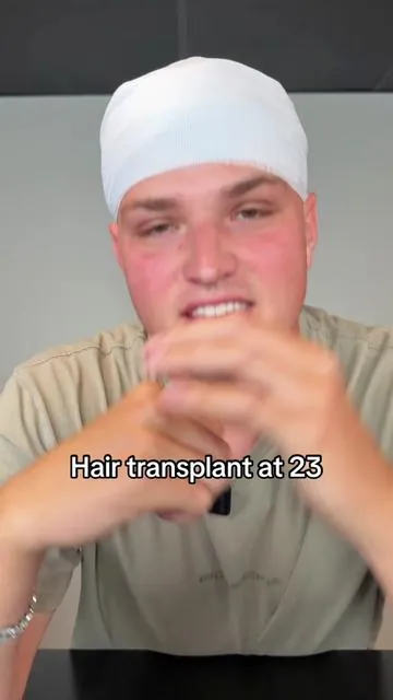 This saved me from spending thousands… #dealsforyoudays #balding #hairloss #transplant #hairgrowth 