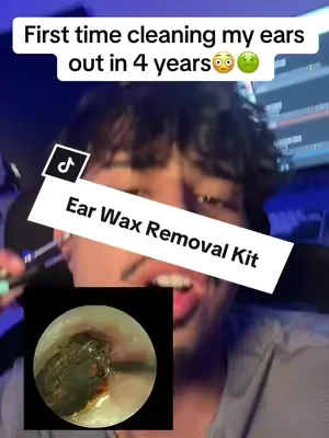 I bought everyone in my family one because how affordable these are #earwaxremoval #earwax #satisfying #tiktokmademebuyit #freeshipping 