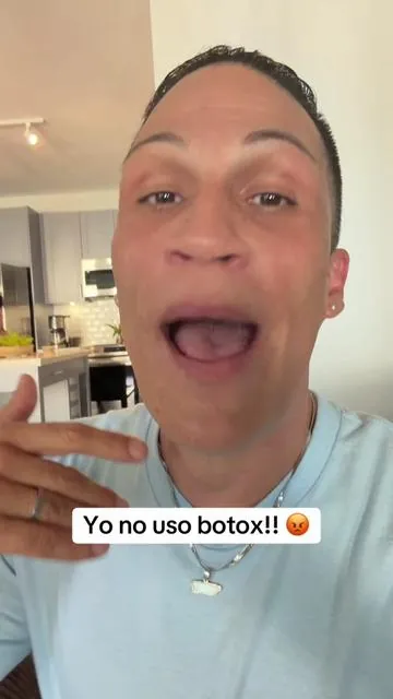 Que no uso botox!! #botox 