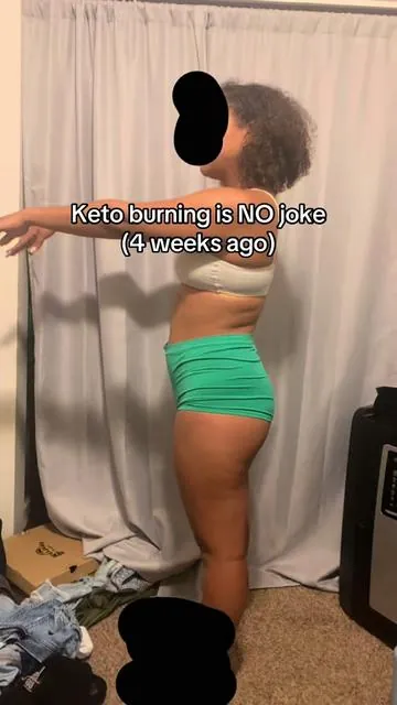 Insane results… #glowup #debloat 