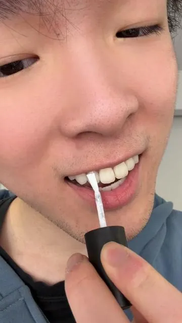 Ngl the results were crazy!! #whiteningmouthwash #bodyaccelteethwhitening #teethwhitening#dealsforyoudays #purplemouthwash