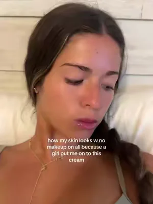 literally changed my entire life tbh #skincare #skintok #glowup 