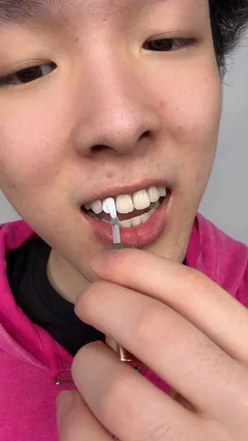 The difference is insane ngl!! #teethwhitening #mouthwash #drdent 