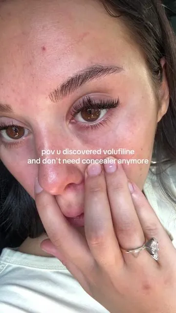 hated wearing concealer anyways #medicube #skincare #eyebags #undereyecircles #howtogetridofdarkcircles  getting rid of dark circles under eyes, volufiline, medicube, medicube pdrn, medicube volufiline, skincare products that work, does volufiline work, volufiline transformation, 